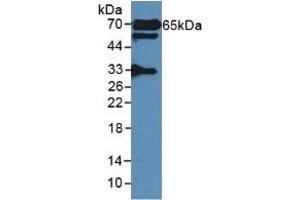 Detection of GAD2 in Rat Serum using Polyclonal Antibody to Glutamate Decarboxylase 2 (GAD2) (GAD65 Antikörper  (AA 188-374))