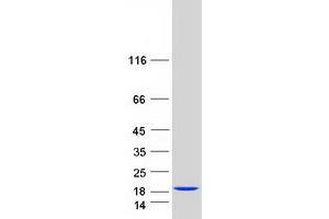 Western Blotting (WB) image for Fatty Acid Binding Protein 3, Muscle and Heart (FABP3) protein (Myc-DYKDDDDK Tag) (ABIN2720661)
