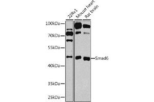 Western blot analysis of extracts of various cell lines, using Smad6 antibody (ABIN3015229, ABIN3015230, ABIN3015231 and ABIN6213893) at 1:1000 dilution. (SMAD6 Antikörper  (AA 257-496))