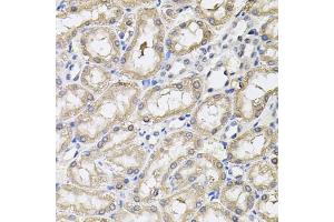 Immunohistochemistry of paraffin-embedded rat kidney using RNF166 antibody (ABIN5974659) (40x lens). (RNF166 Antikörper)