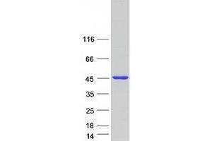 Western Blotting (WB) image for Vacuolar Protein Sorting 26 Homolog B (VPS26B) protein (Myc-DYKDDDDK Tag) (ABIN2735419)