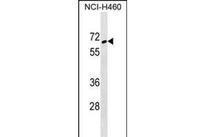 ZNF83 Antibody (N-term) (ABIN1538833 and ABIN2849172) western blot analysis in NCI- cell line lysates (35 μg/lane). (ZNF83 Antikörper  (N-Term))