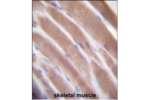 Immunohistochemistry (Paraffin-embedded Sections) (IHC (p)) image for anti-Vascular Endothelial Growth Factor C (VEGFC) (AA 20-49), (N-Term) antibody (ABIN655891)
