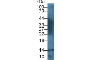Detection of S100A12 in Human Leukocyte lysate using Polyclonal Antibody to S100 Calcium Binding Protein A12 (S100A12) (S100A12 Antikörper  (AA 2-92))