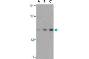 Western blot analysis of TMED10 in mouse brain tissue lysate with TMED10 polyclonal antibody  at (A) 0. (TMED10 Antikörper  (Internal Region))
