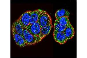 Immunofluorescence (IF) image for anti-GTPase Kras (KRAS) (AA 146-174) antibody (ABIN3031120)