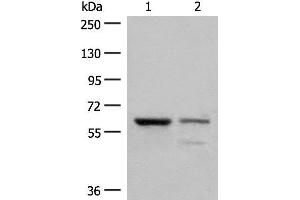 Western blot analysis of Human left kidney cancer tissue and HEPG2 cell lysates using HNF1A Polyclonal Antibody at dilution of 1:200 (HNF1A Antikörper)