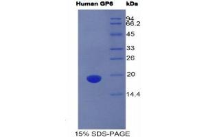 SDS-PAGE (SDS) image for Glycoprotein VI (Platelet) (GP6) (AA 86-231) protein (His tag) (ABIN1981021) (GP6 Protein (AA 86-231) (His tag))