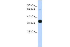 WB Suggested Anti-TNNT1 Antibody Titration:  0. (TNNT1 Antikörper  (Middle Region))