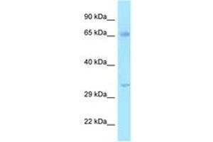 Image no. 1 for anti-Hydroxysteroid (17-Beta) Dehydrogenase 3 (HSD17B3) (AA 51-100) antibody (ABIN6747984) (HSD17B3 Antikörper  (AA 51-100))