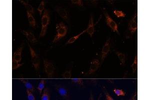 Immunofluorescence analysis of C6 cells using VPS25 Polyclonal Antibody at dilution of 1:100 (40x lens). (VPS25 Antikörper)