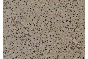 ABIN6276735 at 1/100 staining Mouse liver tissue by IHC-P. (BTK Antikörper  (Internal Region))