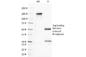 SDS-PAGE (SDS) image for anti-Sema Domain, Immunoglobulin Domain (Ig), Transmembrane Domain (TM) and Short Cytoplasmic Domain, (Semaphorin) 4D (SEMA4D) antibody (ABIN6939082)