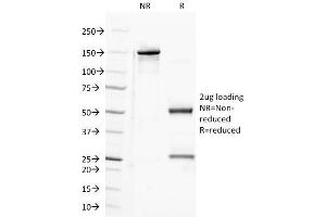 SDS-PAGE Analysis Purified CD100 Mouse Monoclonal Antibody (A8). (SEMA4D/CD100 Antikörper)