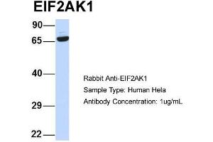 Host:  Rabbit  Target Name:  EIF2AK1  Sample Type:  Human Hela  Antibody Dilution:  1. (EIF2AK1 Antikörper  (N-Term))