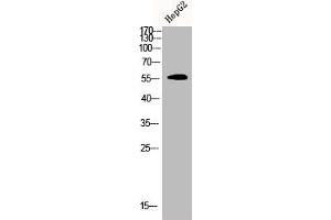 Western Blot analysis of HEPG2 cells using CDYL2 Polyclonal Antibody (CDYL2 Antikörper  (N-Term))