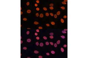 Immunofluorescence analysis of C6 cells using T antibody (ABIN7270900) at dilution of 1:100. (TADA3L Antikörper  (AA 270-369))
