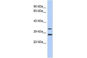 WB Suggested Anti-BIRC7 Antibody Titration:  0. (BIRC7 Antikörper  (Middle Region))