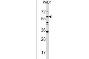 LRRC14B Antibody (N-term) (ABIN1539457 and ABIN2850224) western blot analysis in WiDr cell line lysates (35 μg/lane). (LRRC14B Antikörper  (N-Term))