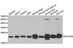 Western blot analysis of extracts of various cell lines, using NDUFS4 antibody. (NDUFS4 Antikörper  (AA 1-175))
