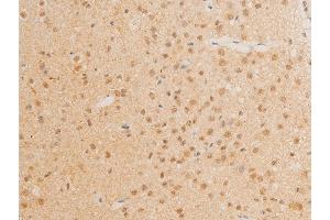 ABIN6267272 at 1/100 staining mouse brain tissue sections by IHC-P. (c-MYC Antikörper  (pThr58))