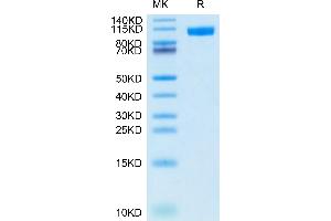 CD56 Protein (AA 20-718) (His tag)