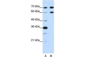 Western Blotting (WB) image for anti-Doublesex and Mab-3 Related Transcription Factor 2 (DMRT2) antibody (ABIN2462015) (DMRT2 Antikörper)