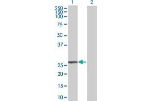 Western Blot analysis of DCXR expression in transfected 293T cell line by DCXR MaxPab polyclonal antibody. (DCXR Antikörper  (AA 1-244))
