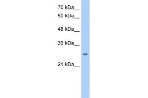 NRG1 (neuregulin 1) Antibody (against the middle region of NRG1) (50ug) validated by WB using Jurkat cell lysate at 0. (Neuregulin 1 Antikörper  (Middle Region))
