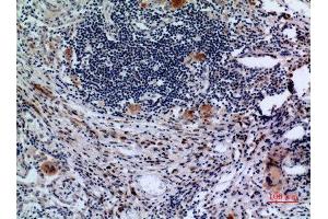 Immunohistochemistry (IHC) analysis of paraffin-embedded Human Lung, antibody was diluted at 1:100. (Transferrin Receptor Antikörper  (N-Term))