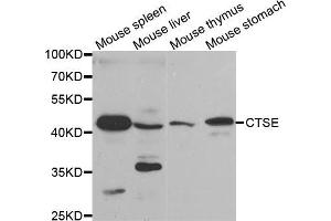Western blot analysis of extracts of various cell lines, using CTSE antibody (ABIN5971444) at 1/200 dilution. (Cathepsin E Antikörper)