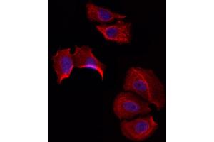 ABIN6258437 and ABIN6274598 staining Hela by IF/ICC.