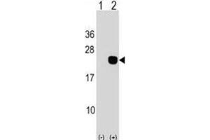 Western Blotting (WB) image for anti-DCMP Deaminase (DCTD) antibody (ABIN2998895) (DCMP Deaminase (DCTD) Antikörper)