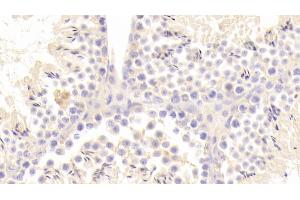 Detection of ACE2 in Mouse Testis Tissue using Polyclonal Antibody to Angiotensin I Converting Enzyme 2 (ACE2) (ACE2 Antikörper  (AA 93-464))