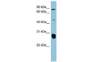 SLC26A4 antibody used at 1 ug/ml to detect target protein. (SLC26A4 Antikörper  (Middle Region))