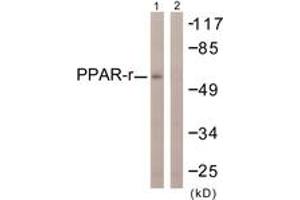 Western blot analysis of extracts from HuvEc cells, using PPAR-gamma (Ab-112) Antibody. (PPARG Antikörper  (AA 78-127))