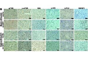 Immunohistochemistry (IHC) image for anti-Mechanistic Target of Rapamycin (serine/threonine Kinase) (mTOR) (C-Term) antibody (ABIN2855088)