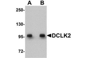 Western blot analysis of DCLK2 in rat brain tissue lysate with AP30277PU-N DCLK2 antibody at (A) 1 and (B) 2 μg/ml. (DCLK2 Antikörper  (C-Term))