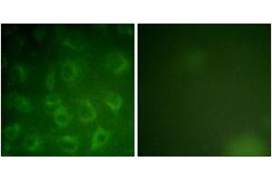 Immunofluorescence analysis of COS7 cells, using PDGFR beta (Ab-1021) Antibody. (PDGFRB Antikörper  (AA 991-1040))