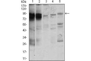 Western blot analysis using STAT5A antibody against K562 (1), MOLT4 (2), HeLa (3), Jurkat (4), and A431 (5) cell lysate. (STAT5A Antikörper  (AA 583-794))