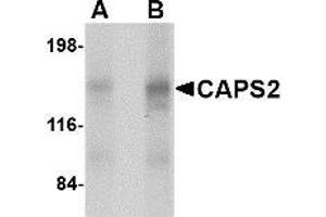 Western blot analysis of CAPS2 in human brain tissue lysate with CAPS2 antibody at (A) 0.