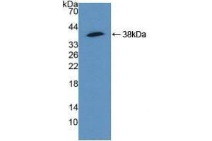 Detection of Recombinant ACTN4, Human using Polyclonal Antibody to Actinin Alpha 4 (ACTN4)