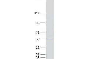 Western Blotting (WB) image for F-Box Protein 27 (FBXO27) protein (Myc-DYKDDDDK Tag) (ABIN2720950)