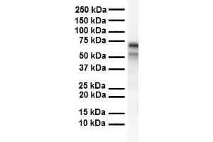 WB Suggested Anti-CES2 antibody Titration: 1 ug/mL Sample Type: Human heart (CES2 Antikörper  (C-Term))