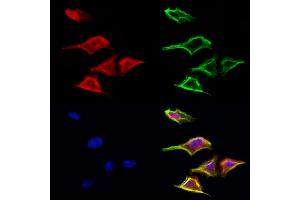 ABIN6265516 and ABIN6272982 staining Hela cells by IF/ICC. (TELO2 Antikörper  (Internal Region))