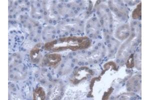 Immunohistochemistry (IHC) image for anti-Thiosulfate Sulfurtransferase (Rhodanese) (TST) (AA 2-297) antibody (ABIN7444661)