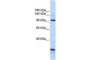 WB Suggested Anti-KIAA1024 Antibody Titration:  0. (KIAA1024 Antikörper  (C-Term))