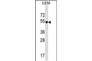 Western blot analysis in CEM cell line lysates (35ug/lane). (ELL3 Antikörper  (C-Term))