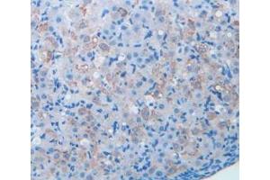 Detection of BDNF in Mouse Ovary Tissue using Polyclonal Antibody to Brain Derived Neurotrophic Factor (BDNF)