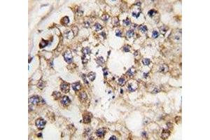 IHC analysis of FFPE human testis tissue stained with PDX1 antibody (PDX1 Antikörper  (AA 40-69))